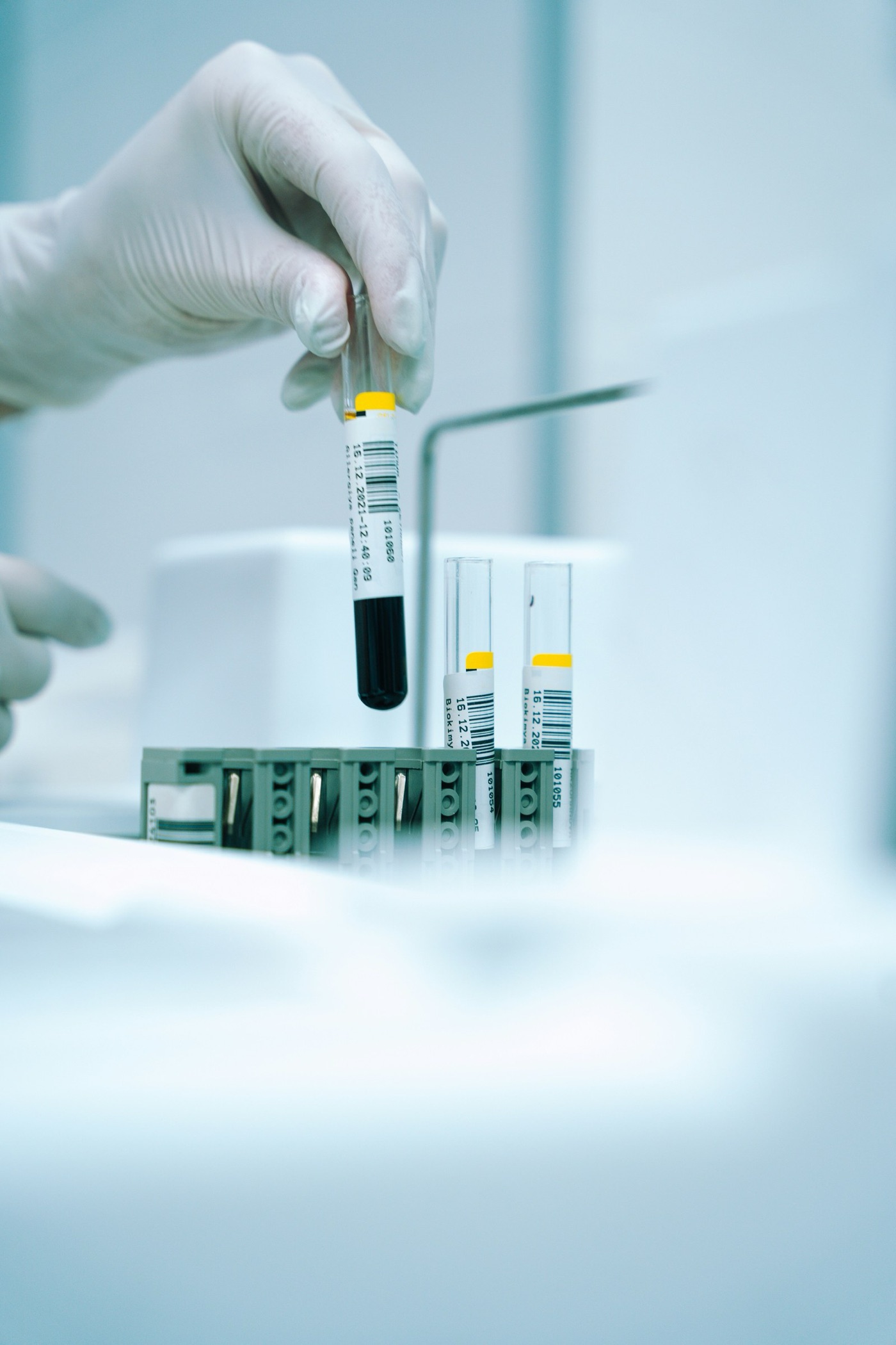 Samples on their way to the laboratory. A utility tests throughout its network; a bottler tests batches at the plant.