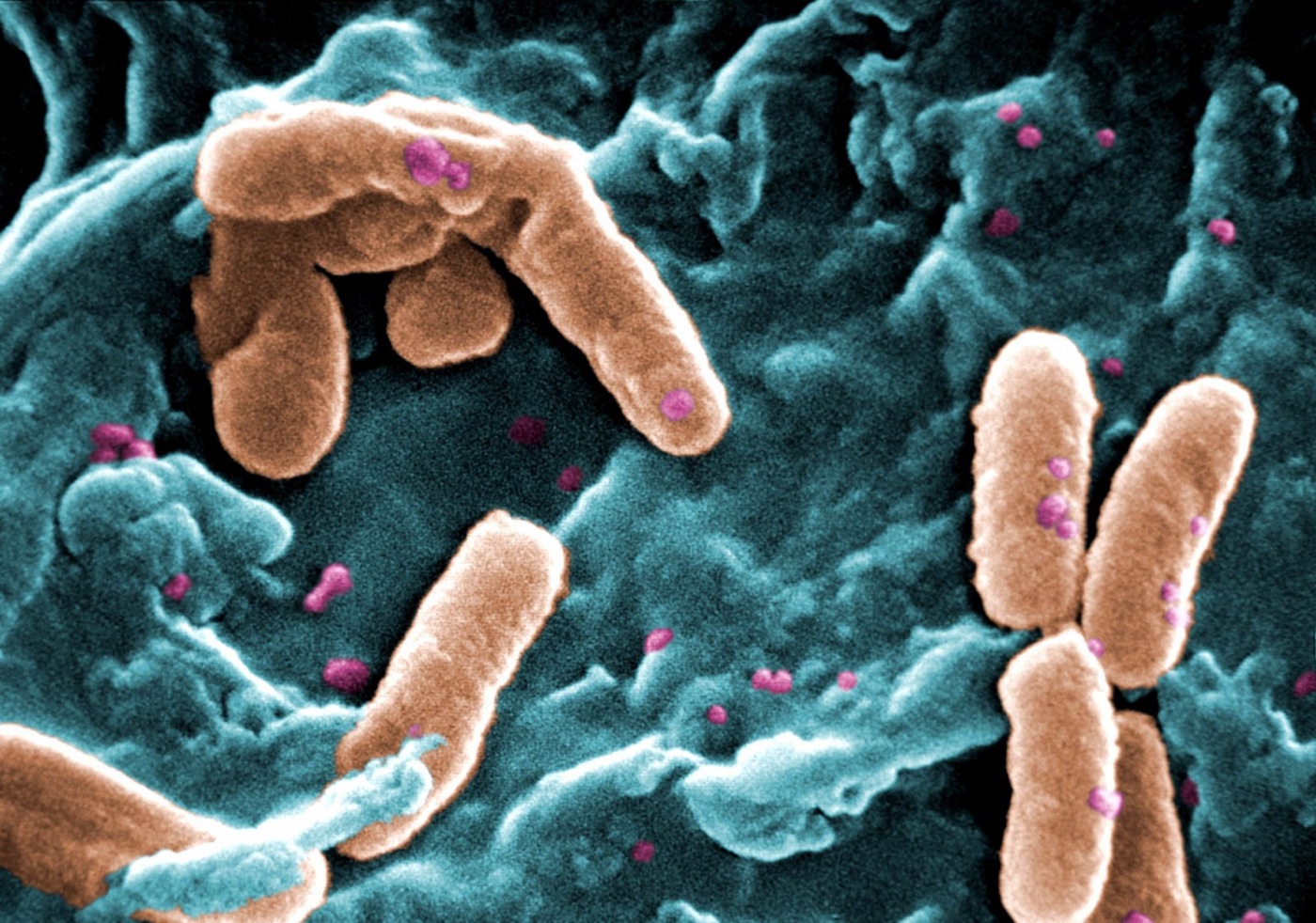 Bacteria under the electron microscope. Dirt in water is their food, and the oxygen in the water is what they breathe.