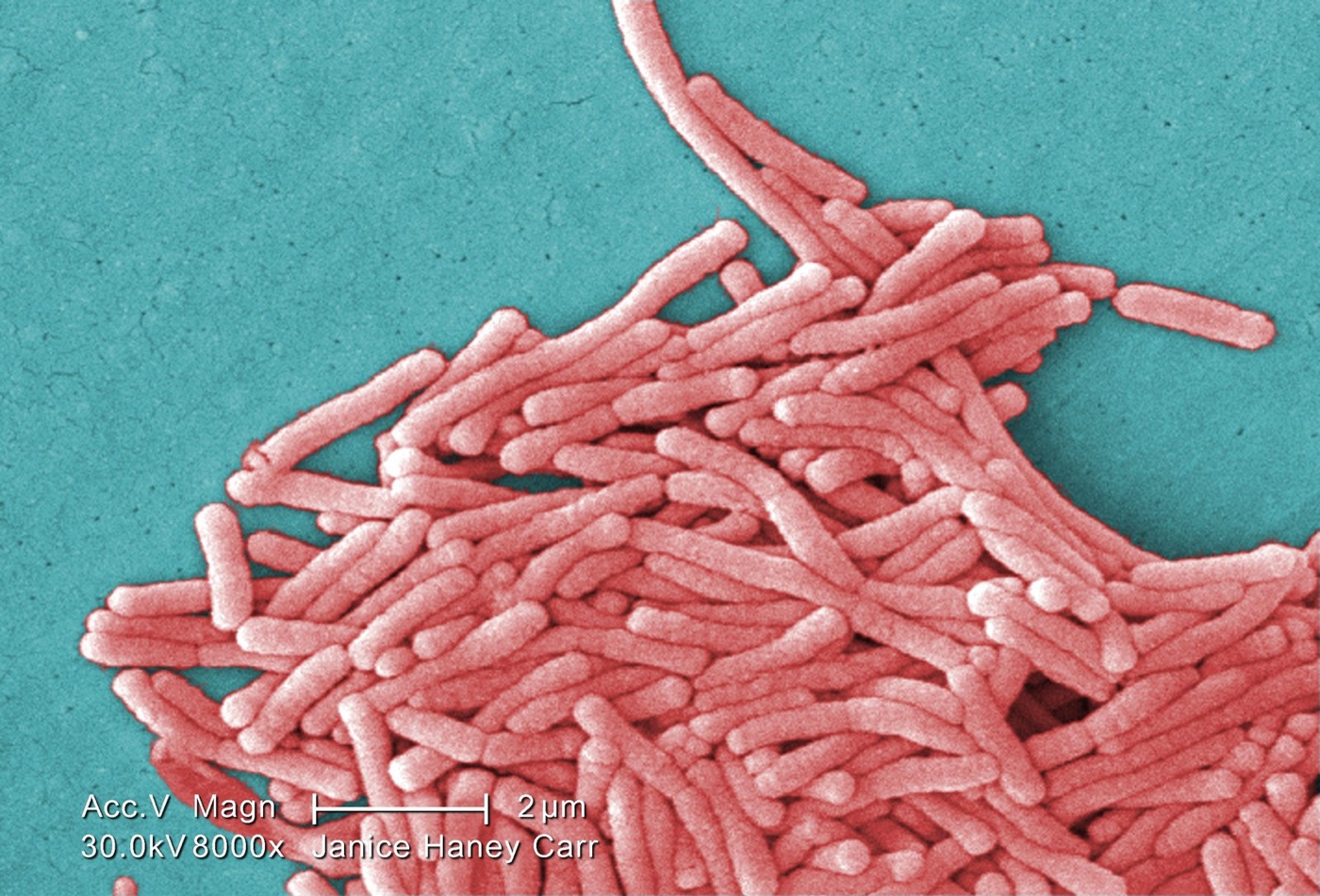 Legionella under the electron microscope. It multiplies in warm, still water and in the slime inside pipes.